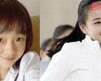 孙妍在整容前照片 被赞的体操女神也是人造美女