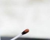 被蜜蜂蛰了怎么办？