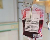 为什么不提倡直系亲属间输血