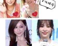 王心凌整容真相，实际是患有脸部蜂窝织炎而导致面部变形