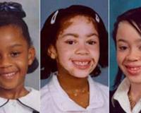 黑人女孩因患白癜风变身白人