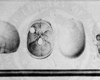 全球十位死不了的人