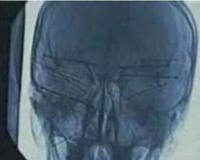 全球十位死不了的人