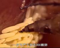 原来 蛆 还有这些用处