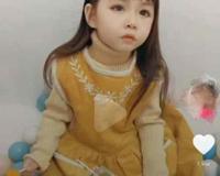 歌舞伎面谱综合征都长的漂亮吗