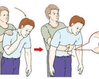 海姆立克急救法怎么操作(尤其新手爸妈一定要会这个能救命的技能)