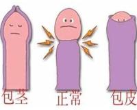 上海割包皮去什么医院好一点呢多少钱一次啊