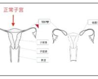 我没有子宫也没有阴道，是传说中的石女