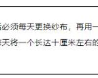 我没有子宫也没有阴道，是传说中的石女