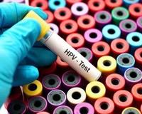 得了性病才后悔，是不是已经晚了