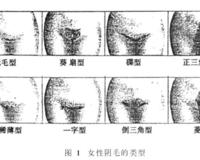私处的毛毛到底要不要脱