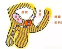送你一份男题攻略,专治男友炎而无性