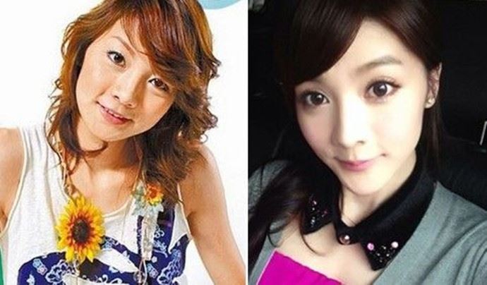 吴亚馨整容前后对比照 长相确实有很大的不一样