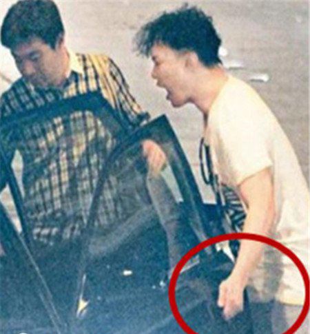 陈奕迅睾丸少一个睾丸 陈奕迅只有一个蛋吗