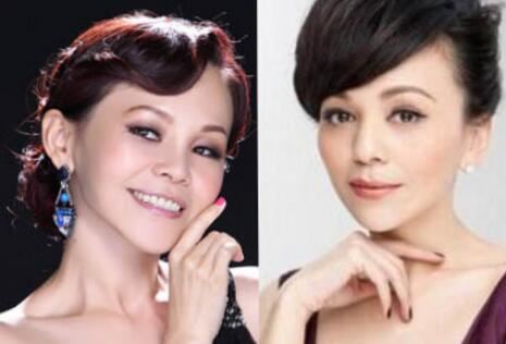 彭佳慧整容了吗 变美之余也不断被疑整鼻