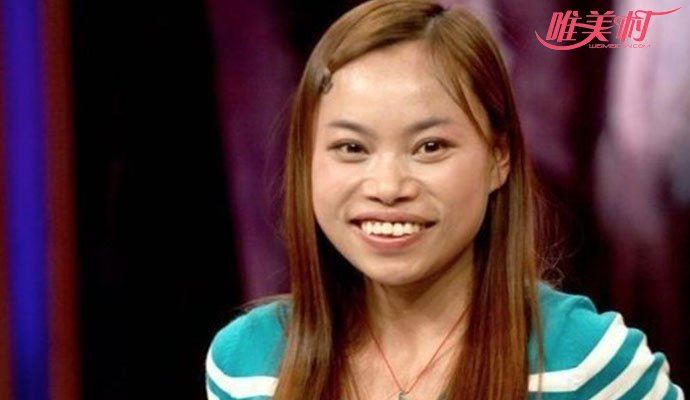 罗玉凤整容后生活现状 罗玉凤整容后照片曝光