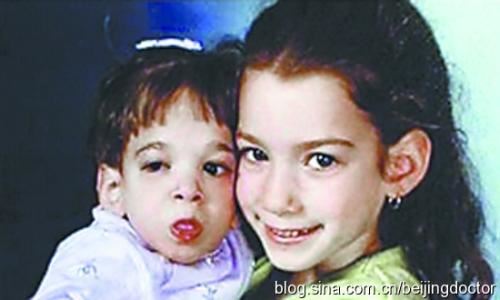 关于不老症科学解释 不老症的人能活多少岁