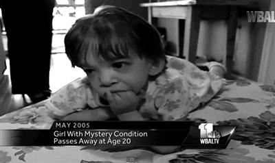 关于不老症科学解释 不老症的人能活多少岁