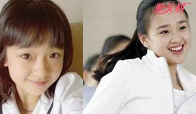 孙妍在整容前照片 被赞的体操女神也是人造美女