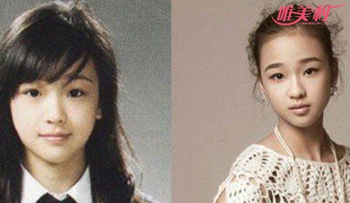 孙妍在整容前照片 被赞的体操女神也是人造美女