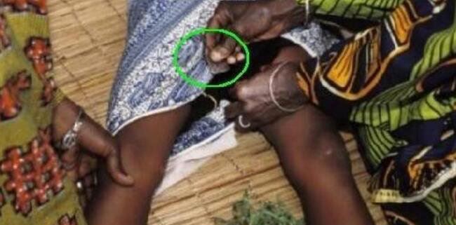 非洲女孩割礼是什么意思的