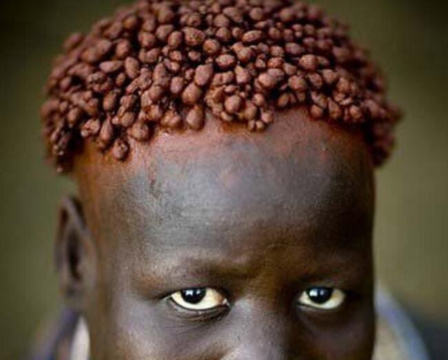 非洲女孩割礼是什么意思的