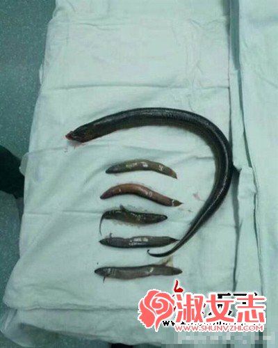 麻椒直播琪琪黄鳝视频 麻椒主播琪琪塞黄鳝死了吗(2)