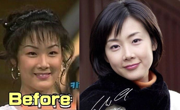 崔智友整容前后照片 崔智友结婚老公是谁