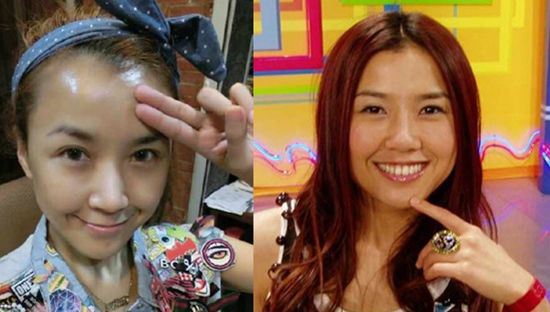 陈学冬旧照前后对比 陈学冬整容真的吗