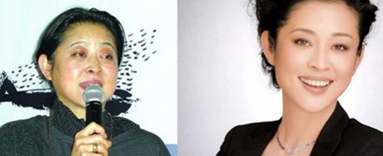 陈学冬旧照前后对比 陈学冬整容真的吗