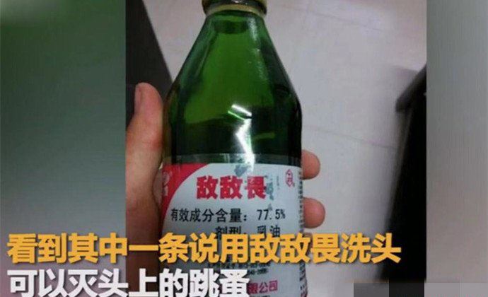 大妈用敌敌畏洗头 竟然相信这种“偏方”