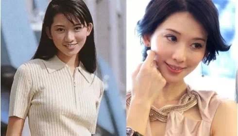 林志玲整过容吗 林志玲整容前后对比照片