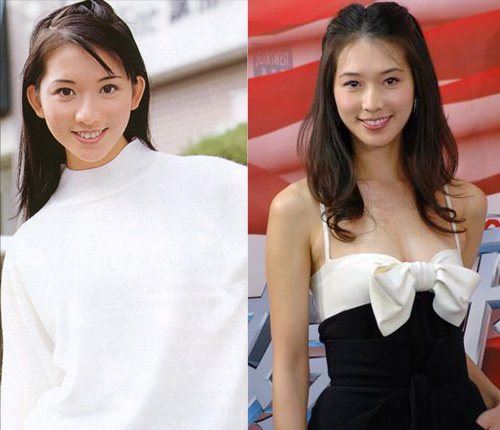 林志玲整过容吗 林志玲整容前后对比照片