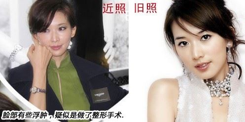 林志玲整过容吗 林志玲整容前后对比照片