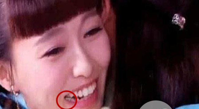 李易峰说唐嫣有口臭真的吗