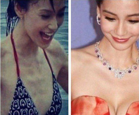 angelababy隆胸了 哪些女明星隆胸上榜