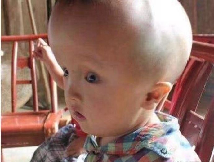 大头娃娃事件 14年过去了大头娃娃现状怎样