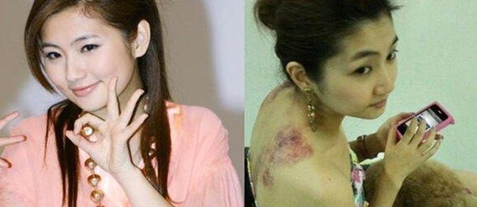 任家萱为什么会烧伤 回顾事件始末究竟发生了什么太震惊