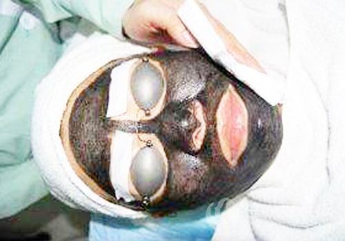 黑脸娃娃多久做一次比较好