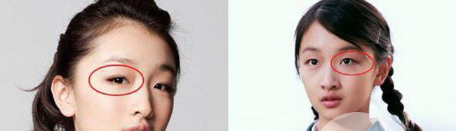 周冬雨双眼皮是割的吗 周冬雨割双眼皮前后对比