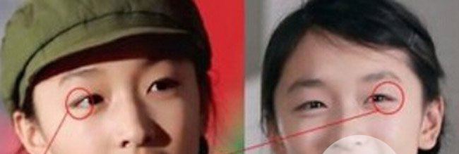 周冬雨双眼皮是割的吗 周冬雨割双眼皮前后对比