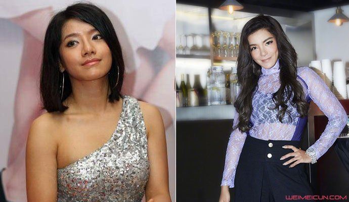 江映蓉近照容貌大变 被质疑整容真的吗