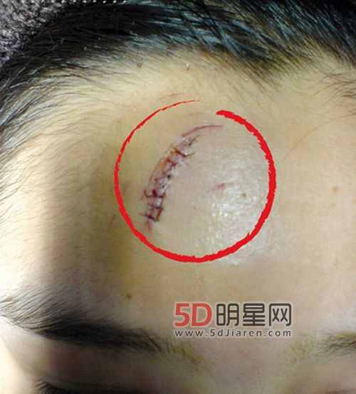 演员何洁个人资料 何洁车祸被死亡事件始末