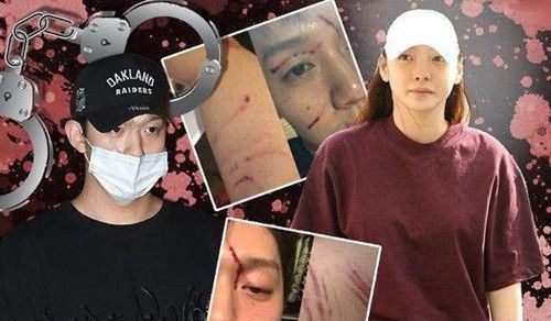 具荷拉欲自杀 曾被打到子宫出血