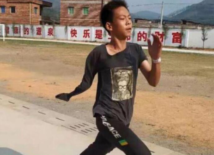 独臂篮球少年注册为运动员 走出梦想第一步但是圆梦很难