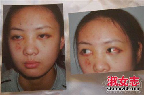 童谣个人资料 童谣被张默殴打怎么回事