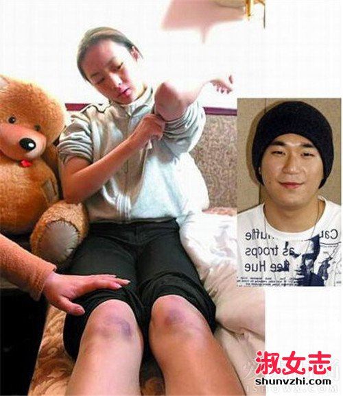 童谣个人资料 童谣被张默殴打怎么回事