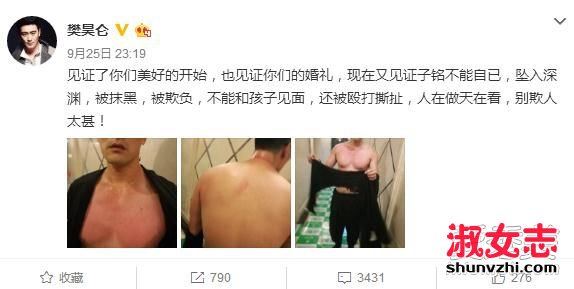 何洁赫子铭离婚了吗 何洁家暴赫子铭真相