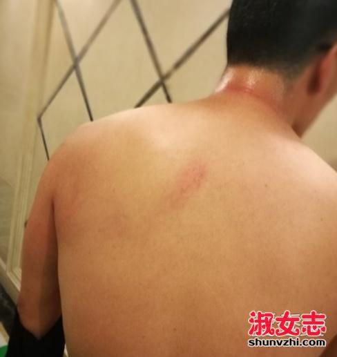 何洁赫子铭离婚了吗 何洁家暴赫子铭真相