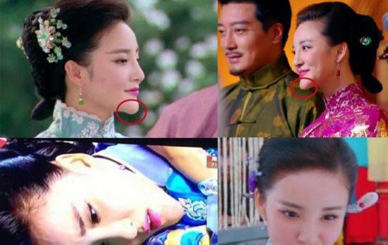 刘雨欣下巴很假 刘雨欣整容了吗？